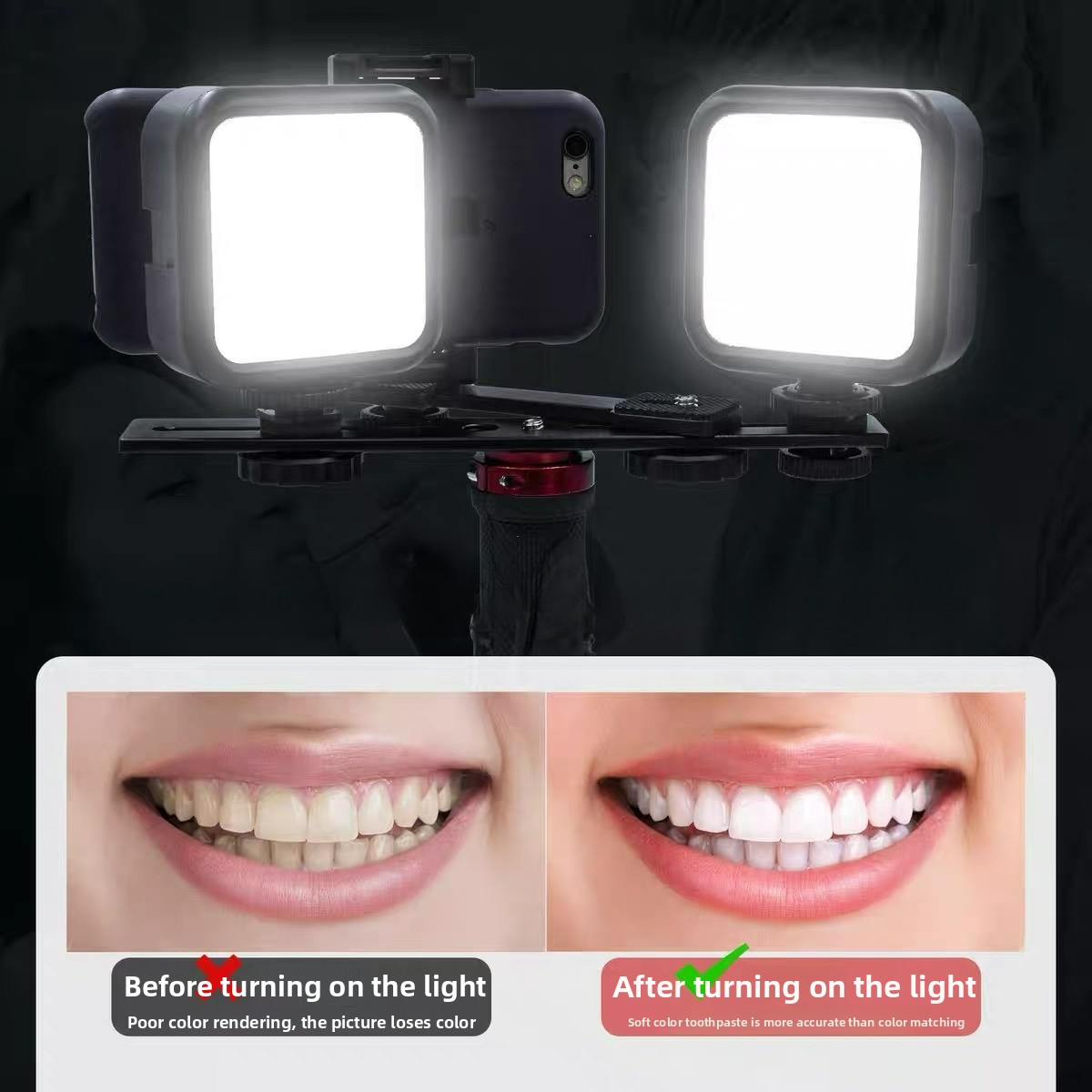 Dental Photography Light with  - Photography Mobile Lighting recension och pris